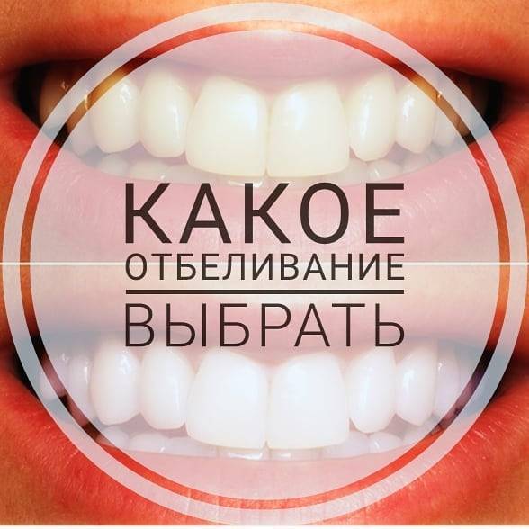 Как проводится отбеливание зубов в стоматологии?