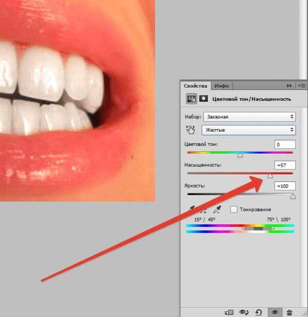 Способы отбеливания зубов в Фотошопе