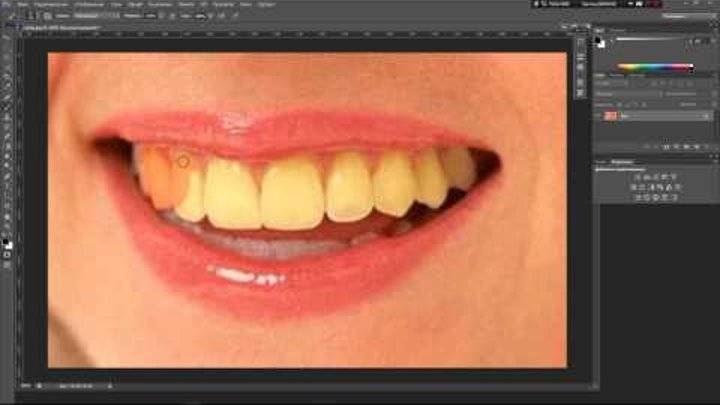 Как отбелить зубы — лучшие способы применяемые в стоматологии