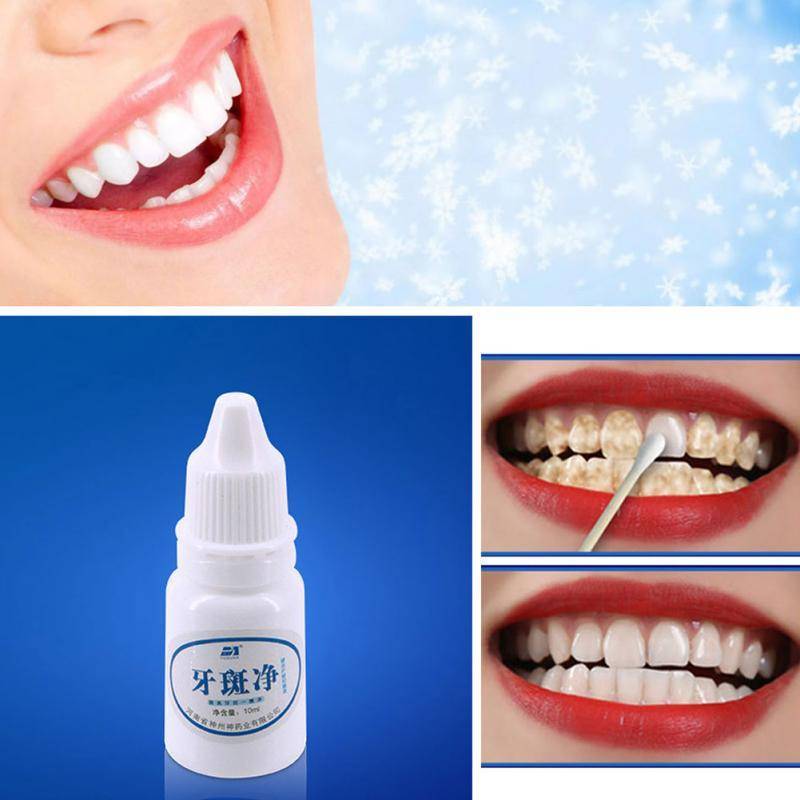 Как отбелить зубы в клинике? виды отбеливания зубов - плюсы и минусы