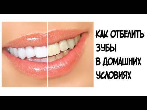 Как пользоваться полосками для отбеливания зубов